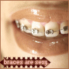 Sexy Braces